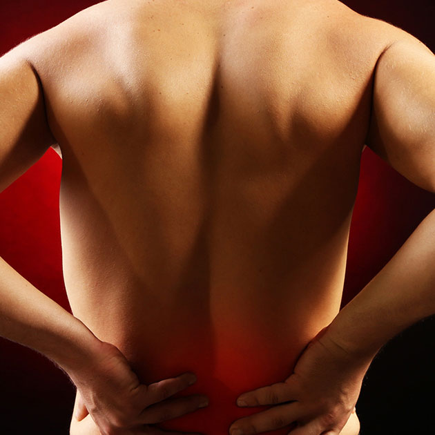 Back Sprain