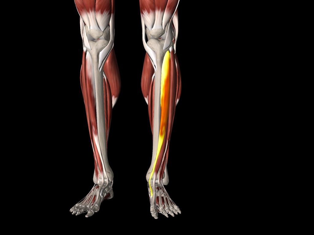 Compartment syndrome of the tibialis anterior muscle and associated fascia accounts for most pain experienced to the front and outside of the shins. 