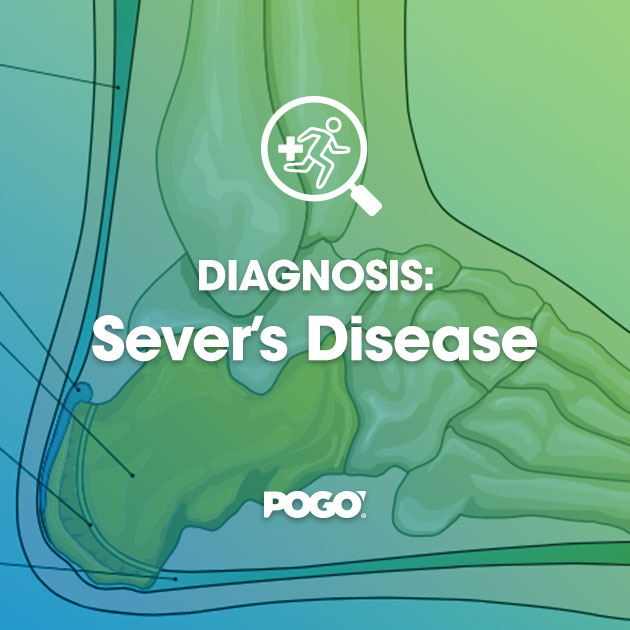 Severs Disease