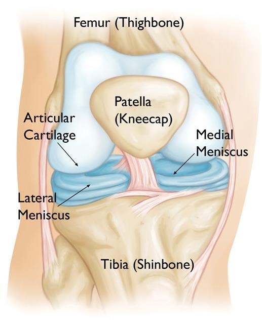 Why your torn Meniscus might be normal | POGO Physio Gold Coast