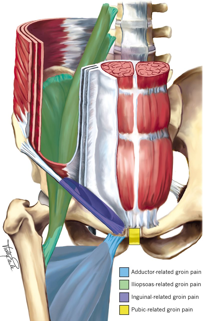 Groin and Pubic Pain - What is the source of symptoms? What is the ...