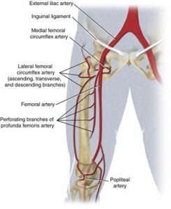 External Iliac Artery Endofibrosis | POGO Physio Gold Coast