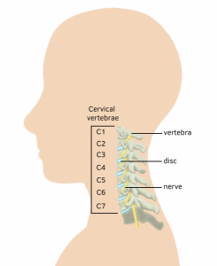 Radiculopathy: What is it and what can I do about it? | POGO Physio ...